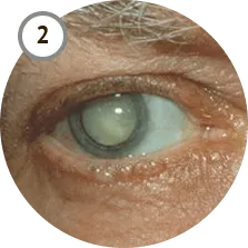 Vizox средство для восстановления зрения