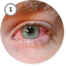 Vizox средство для восстановления зрения