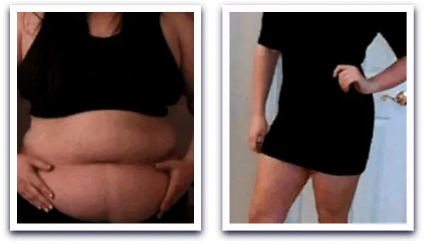 Leptigen Meridian Diet - капсулы для похудения